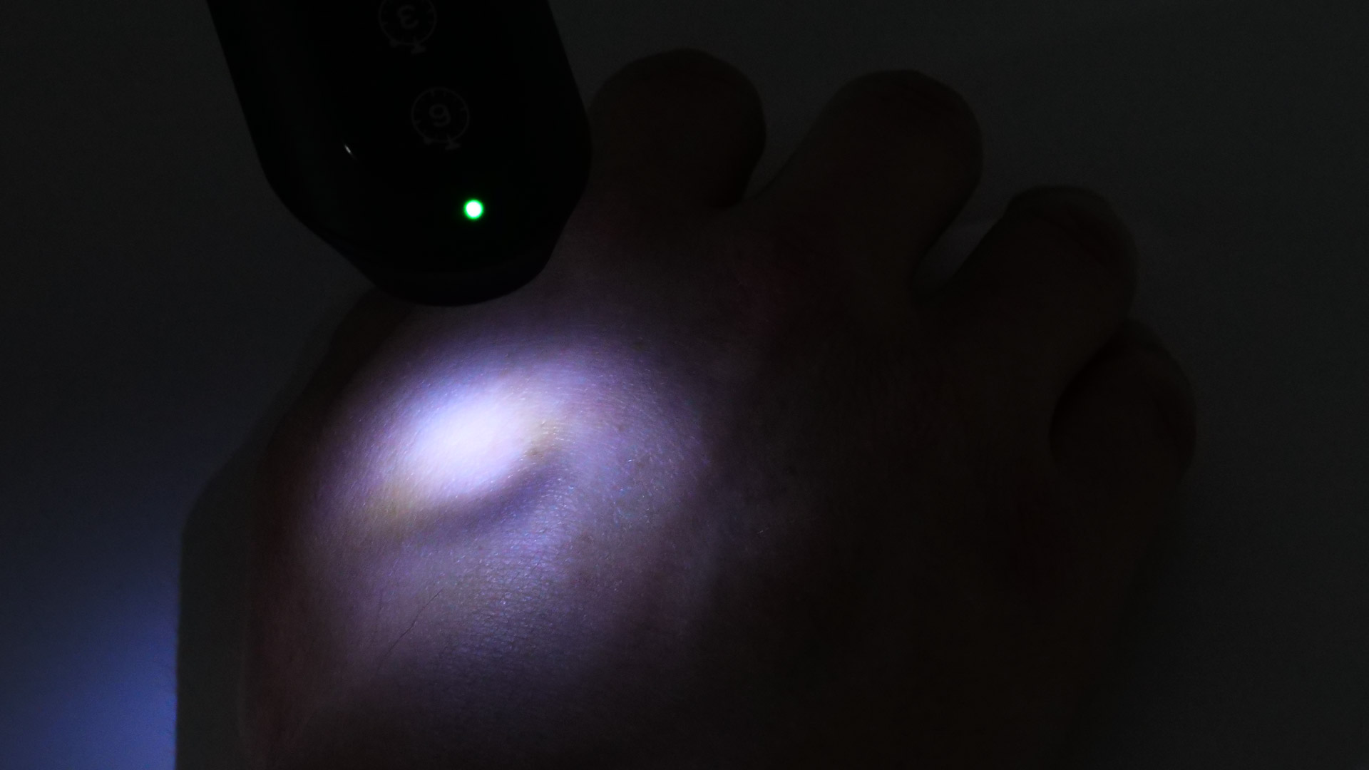 Handrücken bei abendlichen Lichtverhältnissen mit punktueller Beleuchtung des Beurer BiteX Max BR 110